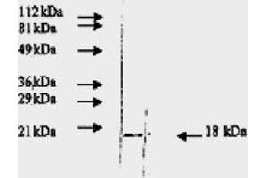 Western Blotting (WB) image for anti-Fibroblast Growth Factor 2 (Basic) (FGF2) antibody (ABIN452474) (FGF2 antibody)