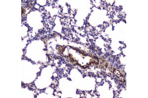 IHC analysis of MYLK using anti-MYLK antibody .