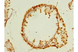 Immunohistochemistry of paraffin-embedded human testis tissue using ABIN7159710 at dilution of 1:100 (MFAP3L antibody  (AA 29-102))