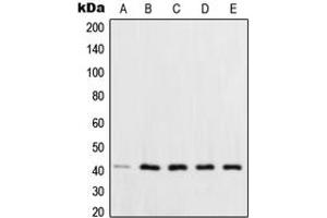 Western blot analysis of XPA expression in HCT116 (A), HeLa (B), HepG2 (C), MCF7 (D), NIH3T3 (E) whole cell lysates. (XPA antibody  (C-Term))