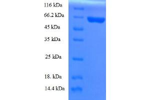 SDS-PAGE (SDS) image for Apolipoprotein A-V (APOA5) (AA 27-367) protein (GST tag) (ABIN4977016)