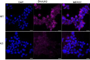 anti-DnaJ (Hsp40) Homolog, Subfamily A, Member 2 (DNAJA2) antibody