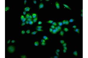 Immunofluorescence staining of PC-3 cells with ABIN7143534 at 1:266, counter-stained with DAPI. (SLC25A4 antibody  (AA 40-74))