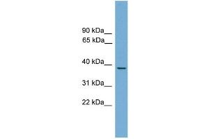 WB Suggested Anti-B230358A15Rik Antibody Titration: 0.
