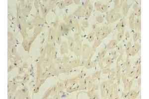 Immunohistochemistry of paraffin-embedded human heart tissue using ABIN7175069 at dilution of 1:100