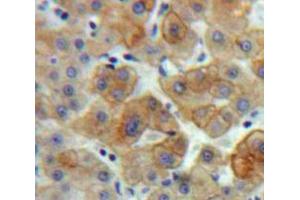 Used in DAB staining on fromalin fixed paraffin-embedded Liver tissue (BCL3 antibody  (AA 82-341))