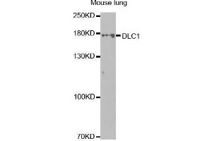 Western Blotting (WB) image for anti-Deleted in Liver Cancer 1 (DLC1) antibody (ABIN1872283) (DLC1 antibody)