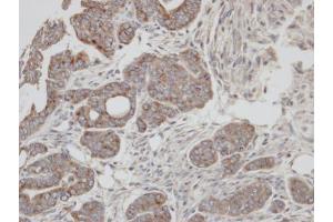 IHC-P Image Immunohistochemical analysis of paraffin-embedded N87 xenograft, using RAB2A, antibody at 1:100 dilution.