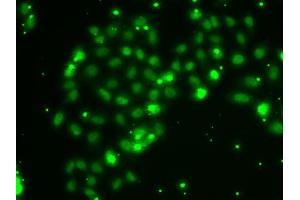 Immunofluorescence analysis of A-549 cells using TXNL4B antibody (ABIN6133086, ABIN6149739, ABIN6149740 and ABIN6222926). (TXNL4B antibody  (AA 1-149))