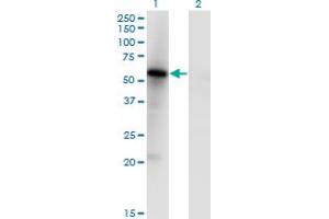 Western Blot analysis of MKNK1 expression in transfected 293T cell line by MKNK1 monoclonal antibody (M05), clone 5E2.
