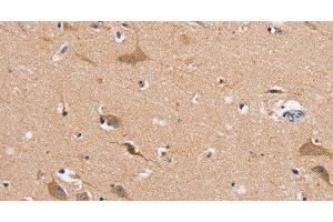 Immunohistochemistry of paraffin-embedded Human brain using MSMB Polyclonal Antibody at dilution of 1:30 (MSMB antibody)