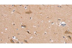 Immunohistochemistry of paraffin-embedded Human brain using MSMB Polyclonal Antibody at dilution of 1:30