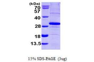 SDS-PAGE (SDS) image for SCO2 Cytochrome C Oxidase Assembly Protein (SCO2) (AA 42-266) protein (His tag) (ABIN667861) (SCO2 Protein (AA 42-266) (His tag))
