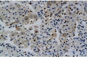 Immunohistochemistry (IHC) image for anti-Interferon gamma (IFNG) (AA 81-166) antibody (ABIN669141) (Interferon gamma antibody  (AA 81-166))
