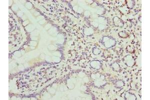 Immunohistochemistry of paraffin-embedded human small intestine tissue using ABIN7149063 at dilution of 1:100 (CRISPLD1 antibody  (AA 24-300))