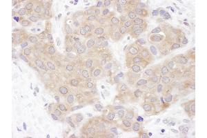Immunohistochemistry (IHC) image for anti-Valosin Containing Protein (p97)/p47 Complex Interacting Protein 1 (Vcpip1) (AA 1100-1150) antibody (ABIN7453810)