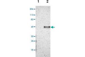 Western blot analysis of Lane 1: Human cell line RT-4, Lane 2: Human cell line U-251MG sp with CADM3 polyclonal antibody .