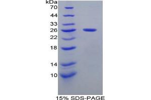 SDS-PAGE analysis of Mouse Smad1 Protein.