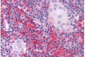 Human Thymus: Formalin-Fixed, Paraffin-Embedded (FFPE) (SOX2 antibody  (N-Term))