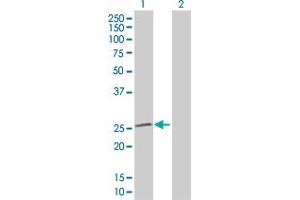 Western Blot analysis of SOD2 expression in transfected 293T cell line by SOD2 MaxPab polyclonal antibody.