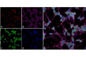 Immunocytochemistry/Immunofluorescence analysis using Mouse Anti-Thyroid Hormone Receptor Monoclonal Antibody, Clone H43 (ABIN6952063). (THRA antibody  (PE))