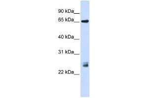 WB Suggested Anti-TRIM8 Antibody Titration:  0.