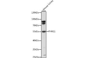 Western blot analysis of extracts of mouse kidney, using PHKG1 antibody (ABIN7269368) at 1:1000 dilution. (PHKG1 antibody  (AA 245-350))