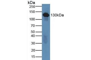 Detection of C6 in Human Serum using Polyclonal Antibody to Complement Component 6 (C6) (C6 antibody  (AA 682-934))