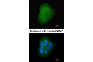 ICC/IF Image Immunofluorescence analysis of paraformaldehyde-fixed A431, using Transmembrane protein 147, antibody at 1:200 dilution. (TMEM147 antibody)