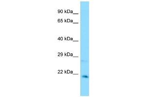 WB Suggested Anti-CXXC4 Antibody Titration: 1. (CXXC4 antibody  (C-Term))