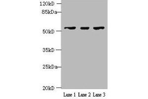 Western blot All lanes: IFIT5 antibody at 2 μg/mL Lane 1: A375 whole cell lysate Lane 2: Jurkat whole cell lysate Lane 3: HepG2 whole cell lysate Secondary Goat polyclonal to rabbit IgG at 1/10000 dilution Predicted band size: 56, 51 kDa Observed band size: 56 kDa (IFIT5 antibody  (AA 107-320))