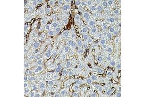 Immunohistochemistry of paraffin-embedded mouse liver using MMP9 antibody (ABIN4904401) at dilution of 1:100 (40x lens).