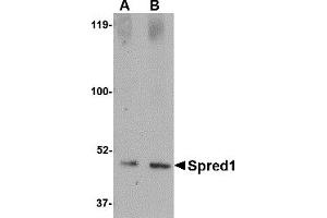 Western Blotting (WB) image for anti-Sprouty-Related, EVH1 Domain Containing 1 (SPRED1) (Middle Region 2) antibody (ABIN1031204) (SPRED1 antibody  (Middle Region 2))