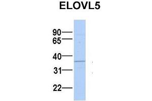 Host:  Rabbit  Target Name:  ELOVL5  Sample Type:  MCF7  Antibody Dilution:  1. (ELOVL5 antibody  (N-Term))