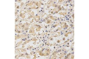 Immunohistochemistry of paraffin-embedded human stomach using TOLLIP antibody at dilution of 1:200 (x400 lens) (TOLLIP antibody  (AA 1-274))