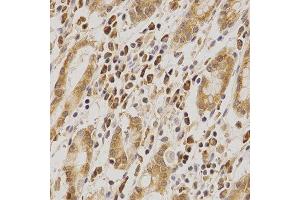 Immunohistochemistry (IHC) image for anti-Mdm2, p53 E3 Ubiquitin Protein Ligase Homolog (Mouse) (MDM2) (AA 130-230) antibody (ABIN3020951)