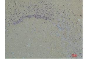 Immunohistochemistry (IHC) analysis of paraffin-embedded Rat Brain Tissue using Glutamate Receptor 1 Rabbit Polyclonal Antibody diluted at 1:200.