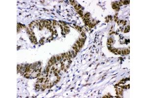 IHC analysis of p95 NBS1 using anti-p95 NBS1 antibody (ABIN3043282).