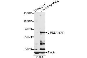Western blot analysis of extracts of HeLa cells, using Phospho-RELA-S311 antibody (ABIN5969962) at 1/2000 dilution. (NF-kB p65 antibody  (pSer311))