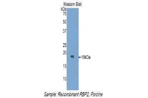 Western Blotting (WB) image for anti-Retinol Binding Protein 2, Cellular (RBP2) (AA 1-134) antibody (ABIN1860412) (RBP2 antibody  (AA 1-134))