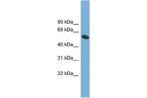 WB Suggested Anti-OMA1 Antibody Titration: 0. (OMA1 antibody  (Middle Region))
