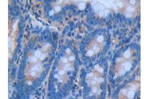 Immunohistochemistry (IHC) image for anti-Interleukin 6 (IL6) (AA 21-211) antibody (ABIN7427093)