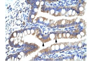 CLIC5 antibody was used for immunohistochemistry at a concentration of 4-8 ug/ml to stain Epithelial cells of intestinal villus (arrows) in Human Intestine.