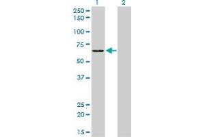 Western Blotting (WB) image for anti-Serine--tRNA Ligase, Cytoplasmic-Like (AA 1-515) antibody (ABIN598916) (Serine--tRNA Ligase, Cytoplasmic-Like (AA 1-515) antibody)