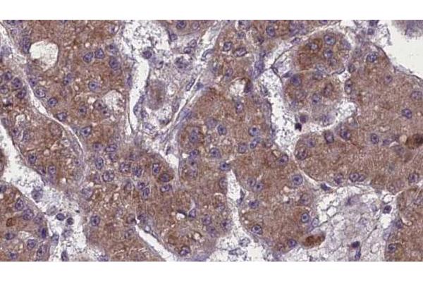 OR52K2 antibody