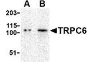 Western blot analysis of TRPC6 in K562 cell lysate with this product at (A) 0. (TRPC6 antibody  (N-Term))