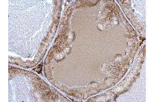 IHC-P Image alpha 1a Adrenergic Receptor antibody detects alpha 1a Adrenergic Receptor protein at cytosol on mouse prostate by immunohistochemical analysis. (alpha 1 Adrenergic Receptor antibody)