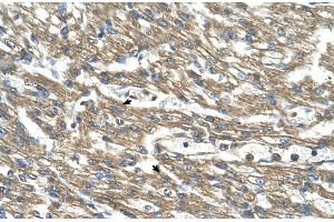 Human Heart (CTH antibody  (C-Term))