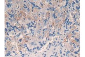 DAB staining on IHC-P; Samples: Mouse Ovary Tissue (CYP11A1 antibody  (AA 329-526))