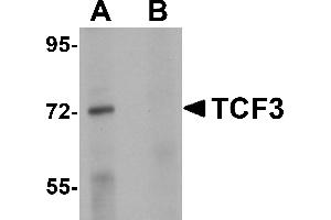 Western Blotting (WB) image for anti-Transcription Factor 3 (E2A Immunoglobulin Enhancer Binding Factors E12/E47) (TCF3) (N-Term) antibody (ABIN1031605) (TCF3 antibody  (N-Term))